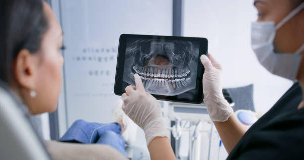 Licensed Root Canal Treatment service in Cotati, CA - Smile Center Dentistry